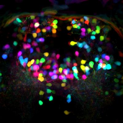 Neuroimaging photo